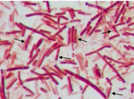 Gambar 4.2 Sediaan P. gingivalis, terlihat berwarna merah muda pada pemeriksaan mikroskopik sesuai dengan sifat bakteri, yaitu gram negatif  berbentuk kokobasil  (Pengecatan Gram, pembesaran 1000x)