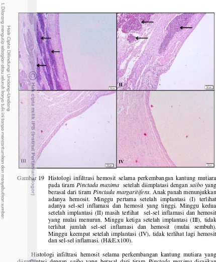 Gambar 19 Histologi infiltrasi hemosit selama perkembangan kantung mutiara 
