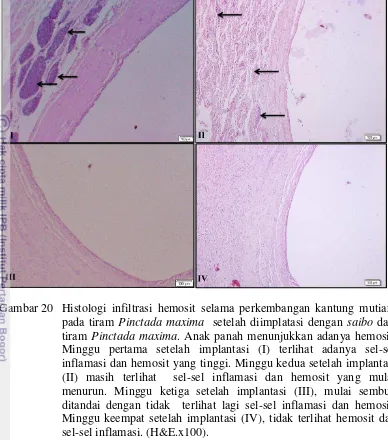Gambar 20 Histologi infiltrasi hemosit selama perkembangan kantung mutiara 