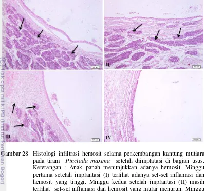 Gambar 28 Histologi infiltrasi hemosit selama perkembangan kantung mutiara pada tiram  Pinctada maxima  setelah diimplatasi di bagian usus