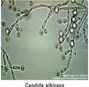 Gambar 2.7 Candida albicans
