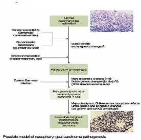 Gambar 2.4 Pathogenesis karsinoma nasofaring (Tao, 2007) 