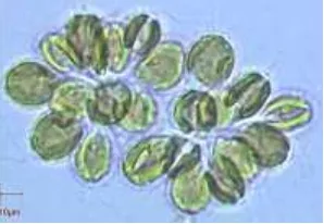 Gambar II.5 Organisme Alga Keemasan 