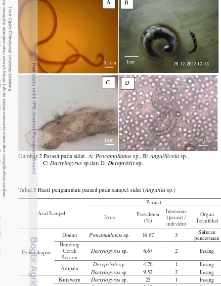 Gambar 2 Parasit pada sidat. A: Procamallanus sp., B: Anguillicola sp.,                