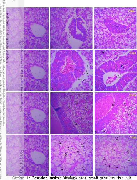 Gambar 12 Perubahan struktur histologis yang terjadi pada hati ikan nila 
