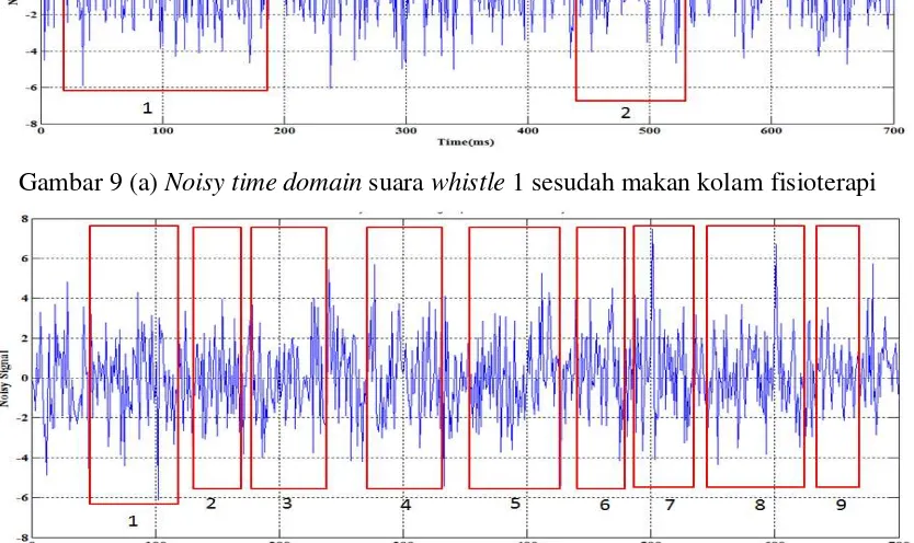 Gambar 8 (d) Noisy time domain suara whistle 4 sebelum makan kolam fisioterapi 