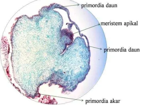 Gambar 5. Tahapan perkembangan embriogenesis somatik manggis klon Leuwiliang (A) kalus semi friable; (B) kalus menghijau; (C) globular; dan (D) kotiledon