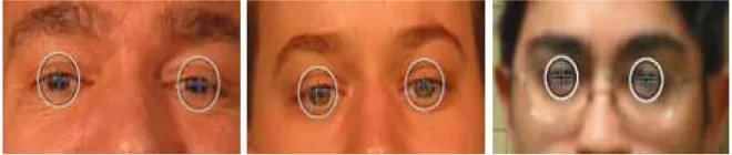 Figure 2.2.2(a): Face and Eye Detection Results