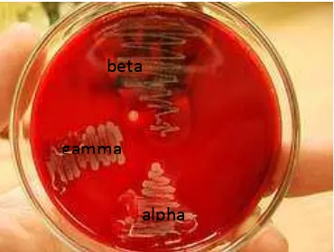 Gambar 3.  Tampilan koloni Streptococcus sp pada media Blood Agar Plate. 