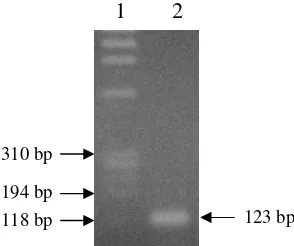 Gambar 9 Hasil amplifikasi eglA dengan PCR yang dideteksi dengan elektroforesis menggunakan gel agarosa 1% (b/v)