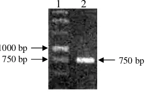 Gambar  10 Koloni E. coli hasil transformasi yang ditumbuhkan dalam media selektif yang mengandung ampisilin, X-gal dan IPTG