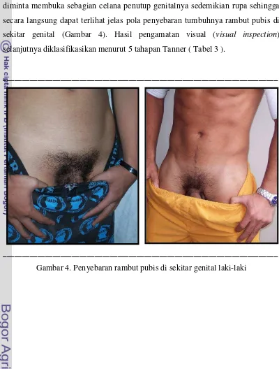 Gambar 4. Penyebaran rambut pubis di sekitar genital laki-laki 