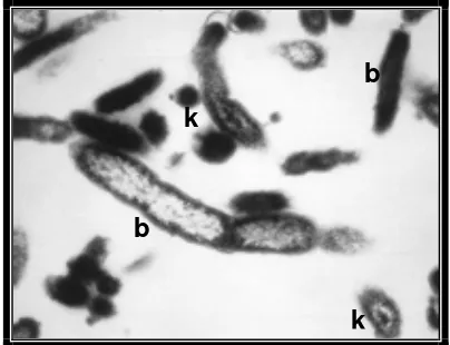 Gambar 2    C. burnetii dengan mikrograf elektron pada pembesaran 75 000  kali,  et al.