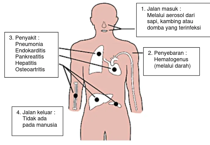 Gambar 4   Mekanisme infeksi dan gejala penyakit Q fever pada manusia (CDC 2005). 