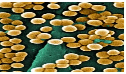 Gambar 2. Bentuk Bakteri S. aureus (sumber: Ernest, 1996) 
