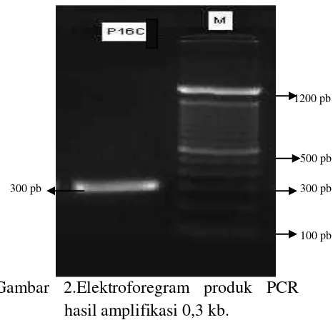 Gambar 2.Elektroforegram produk PCR 
