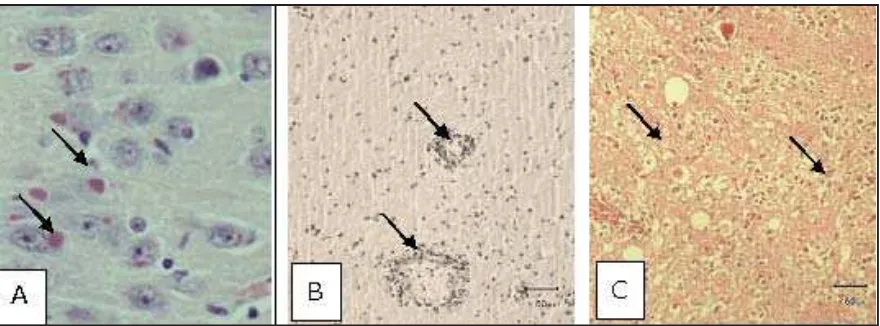 Gambar 1. Lesi-lesi pada otak anjing penderita rabies di Bali.  A: Badan badan Negri (Negribodies)  B: Perivascular cuffing;  C: Spongiosis