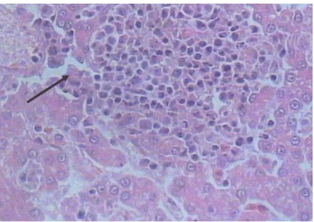 Gambar 8  Fotomikrograf hati ayam yang diinfeksi virus Marek (MDV)                      dosis 1 x 103 EID50 pewarnaan Hematoksilin-Eosin (HE)