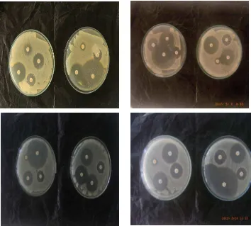 Gambar 4 menjelaskan hasil uji kepekaan kuman Staphylococcus aureusterhadap beberapa antibiotika secara konvensional dengan metode (Kirby-Bauer)