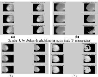 Gambar 6. Perubahan thresholding (a) mikrokalsifikasi jinak (b) mikrokalsifikasi ganas 