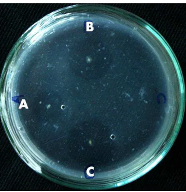 Figure 1. Clear zone that shows fibrinolytic activity of bacterial isolates a) WU 021055*; b) WU 021001*; c) WU 021012* in fibrin media, with respectively 5.86, 6.95, and 7.01