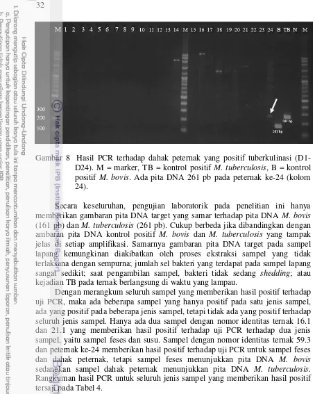 Gambar 8  Hasil PCR terhadap dahak peternak yang positif tuberkulinasi (D1-