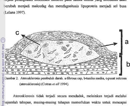 Gambar 2. Aterosklerosis pembuluh daral~. asfibrous cap, bstunika media, c;pusat nekrosa 