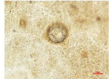 Gambar 8  Pemeriksaan mikroskopis telur Taenia yang berasal dari sampel feses 