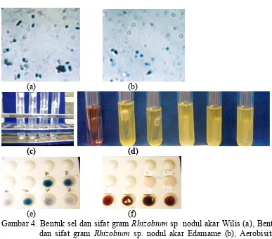 Gambar 4. Bentuk sel dan sifat gram Rhizobium sp. nodul akar Wilis (a), Bentuk sel 