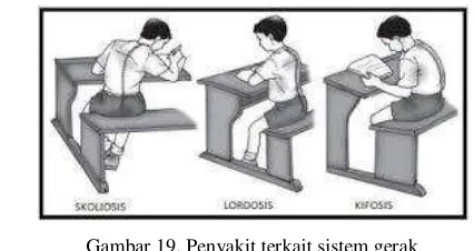 Gambar 18. Macam-macam Otot 