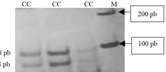 Gambar 2  Fragmen DNA hasil pemotongan enzim  Ava II gen ASS ekson 5 kromosom  11  sapi  perah  FH  pada  gel  poliakrilamid  6%
