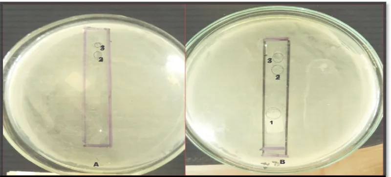 Gambar 8. Hasil uji bioautografi fraksi nonpolar ekstrak bawang putih terhadap (A) P.aeruginosa  (B) S.mutans