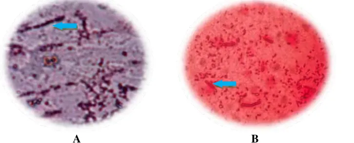 Gambar 3. Hasil Pengecatan Gram Bakteri Streptococcus mutans  (A) dan Pseudomonas aeruginosa (B)  Bakteri Gram negatif adalah bakteri yang pada pengecatan Gram tidak tahan alkohol sehingga 