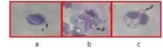 Gambar 24.  Fagositosis  yang dilakukan oleh limfosit (a), monosit (b), 