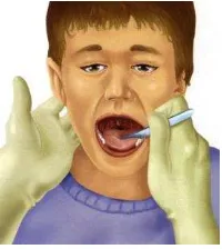 Gambar 2.7 Pemeriksaan tonsil pada anak (Shah dan Tewfik, 2014) 