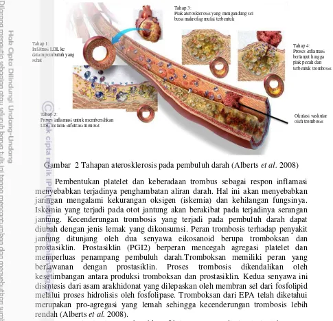Gambar  2 Tahapan aterosklerosis pada pembuluh darah (Alberts et al. 2008) 