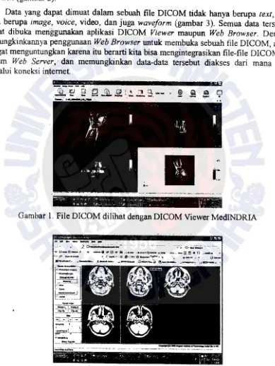 Gambar 1. File DICOM dilihat dengan DICOM Viewer MediNDRIA 