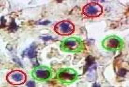 Fig. 1  The example of imunohistochemistry staining in  antibody (Daco). Green circled is positive cells and red circle lung mice with anti-mouse NKp46 (Bioss) and secondary is negative (CX3100 Olympus Microscope, magnification 100×, Optilab doc, Histology