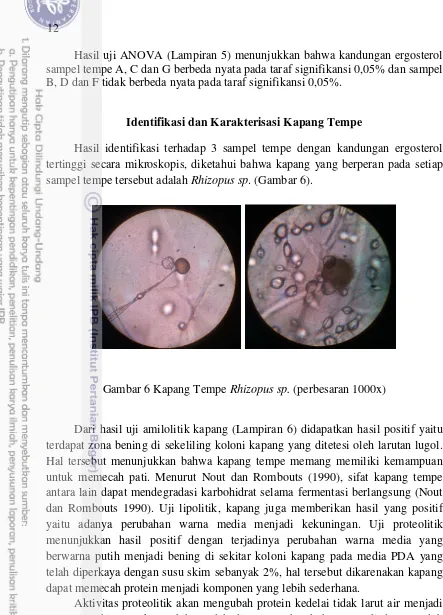 Gambar 6 Kapang Tempe Rhizopus sp. (perbesaran 1000x) 