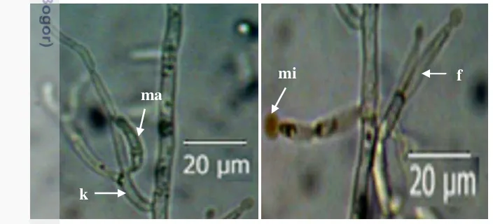 Gambar 1 Morfologi Fusarium sp1. hasil identifikasi asal tomat apel. k-konidiofor, 