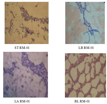 Gambar 5. Morfologi Bakteri Asam Laktat  (St RM-01 dan Lb RM-01) dan   Bakteri Probiotik (La RM-01dan Bl RM-01)                                  