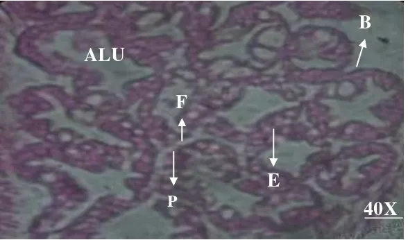 Gambar 7. Hepatopancreas udang uji yang melalui perlakuan pada 0.06 ppm. B = B- Cells, F = F-Cells, E = E-Cells, R = R-Cells, Lu =  Lumen, H & E, 40 X 