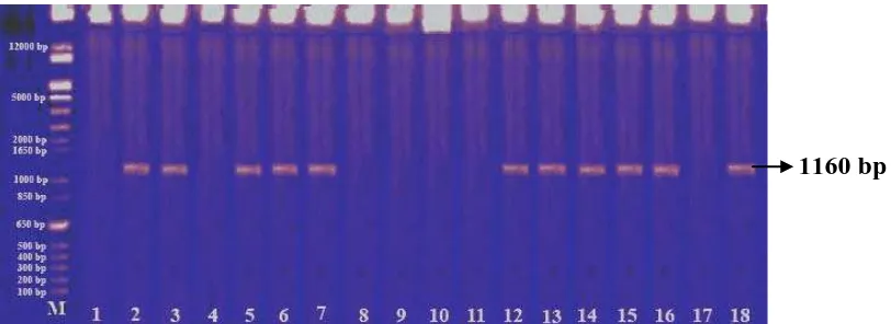 Gambar 3. Visualisasi DNA hasil deteksi penyakit CVPD pada sampel daun tanaman jeruk di tiap lokasi
