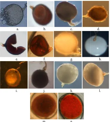 Gambar .1 Hasil isolasi Glomus dengandengan pembesaran(m dan n)solasi dan identifikasi fungi mikoriza arbuskulabuskular (FMA) padaaran 200 kali (a-g), tipe spora)(h-l), dan tipe sporatanaman jeruk di Desa Kerta