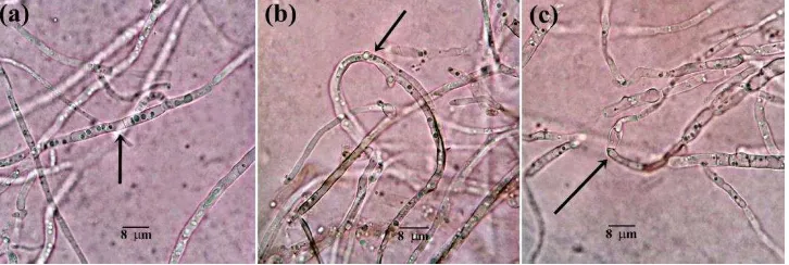 Gambar 9 Respon pertumbuhan hifa Po pada uji antagonis terhadap aktinomiset filosfer padi menggunakan metode dual culture pada media PDA, diamati dibawah mikroskop cahaya dengan perbesaran 400x