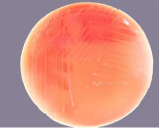 Gambar 5.    Koloni isolat S. iniae pada media darah yang diisolasi dari organ ginjal