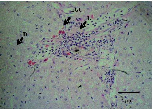 Gambar 23.    Sel radang EGC  dan limfosit (L) pada jaringan sel hati                Pewarnaan HE