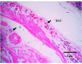 Gambar 31.  Infiltrasi sel radang (EGC) dan makrofag (M) pada epikard  jantung.      Pewarnaan HE