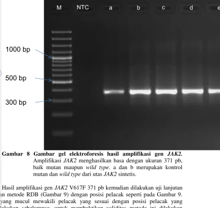 Gambar 8 Gambar gel elektroforesis hasil amplifikasi gen JAK2. 