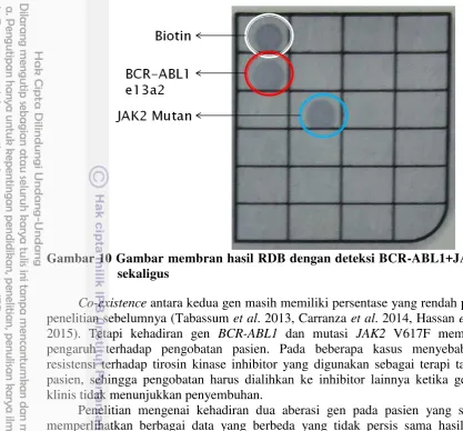 Gambar 10 Gambar membran hasil RDB dengan deteksi BCR-ABL1+JAK2 